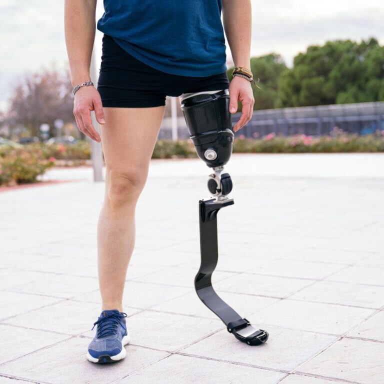 Top 5 Prosthetic manufacturers redefining mobility with innovative technology 768x768