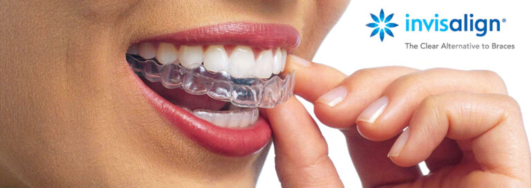 best invisalign dentist 768x272