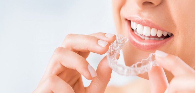 best invisalign dentist near me 768x365