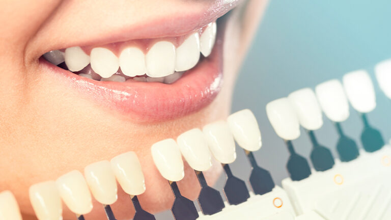 cosmetic dentistry 768x432