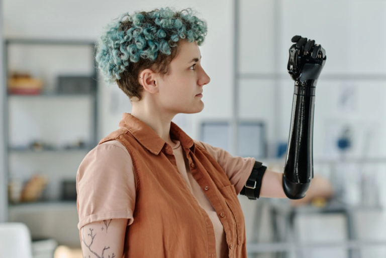 prosthetic hand 768x515