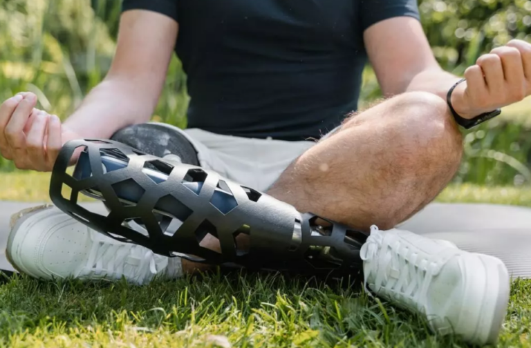 prosthetic leg 768x504