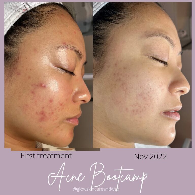 SaveClip.App 314999586 666071361736117 2469673400407641496 n 768x768