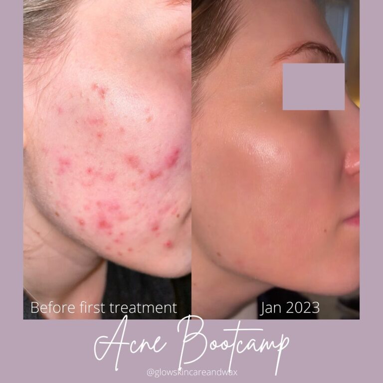 SaveClip.App 329248273 2360270470797276 5917561752278020693 n 768x768