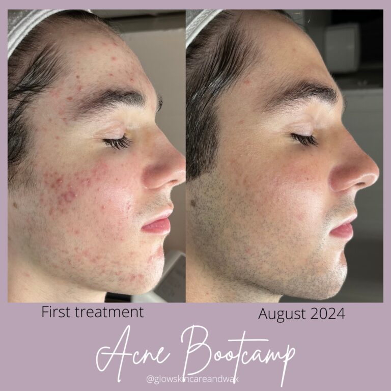 SaveClip.App 491917512 1256563986470175 4547868043941172120 n 768x768